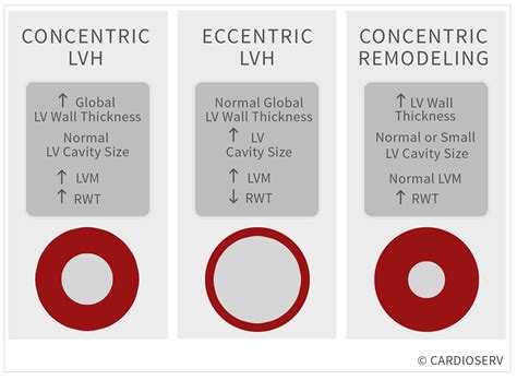 lv overload or aspecific change|mild concentric lvh is dangerous.